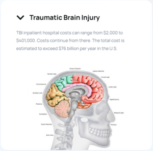 TBI Cost Infographic